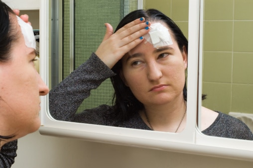 women looking in a mirror at a bandage on her forehead 