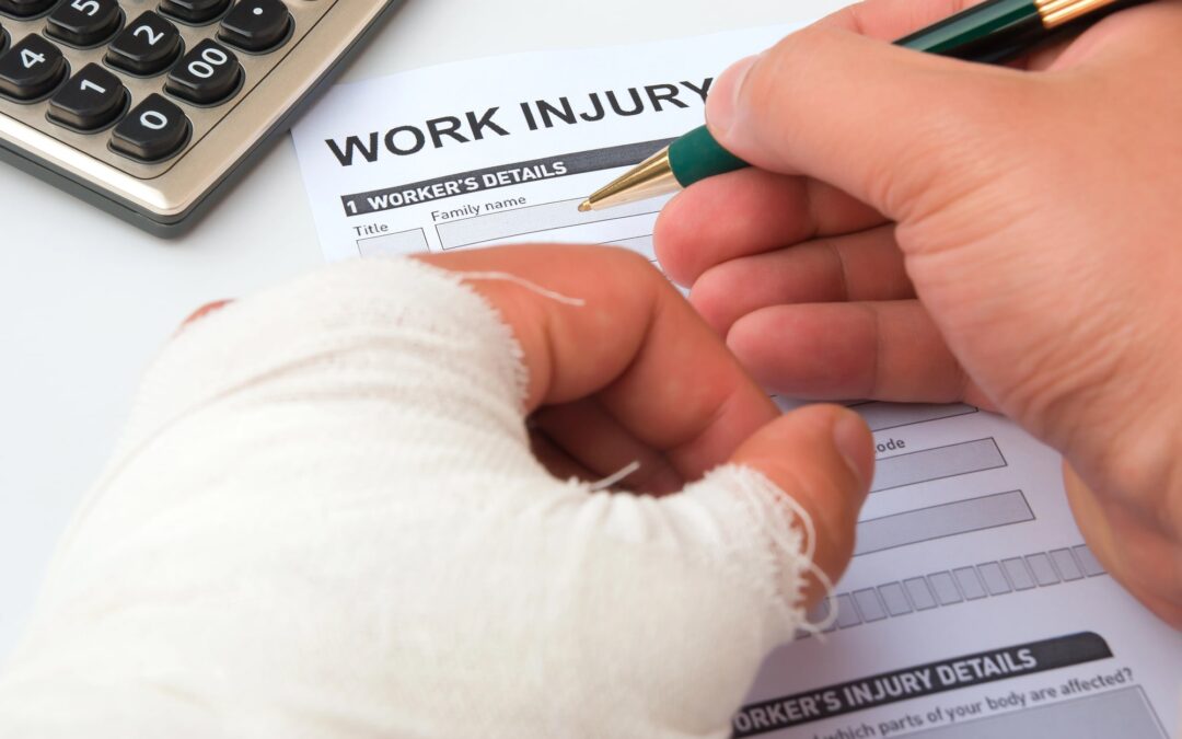 What To Do After A Burn At Work