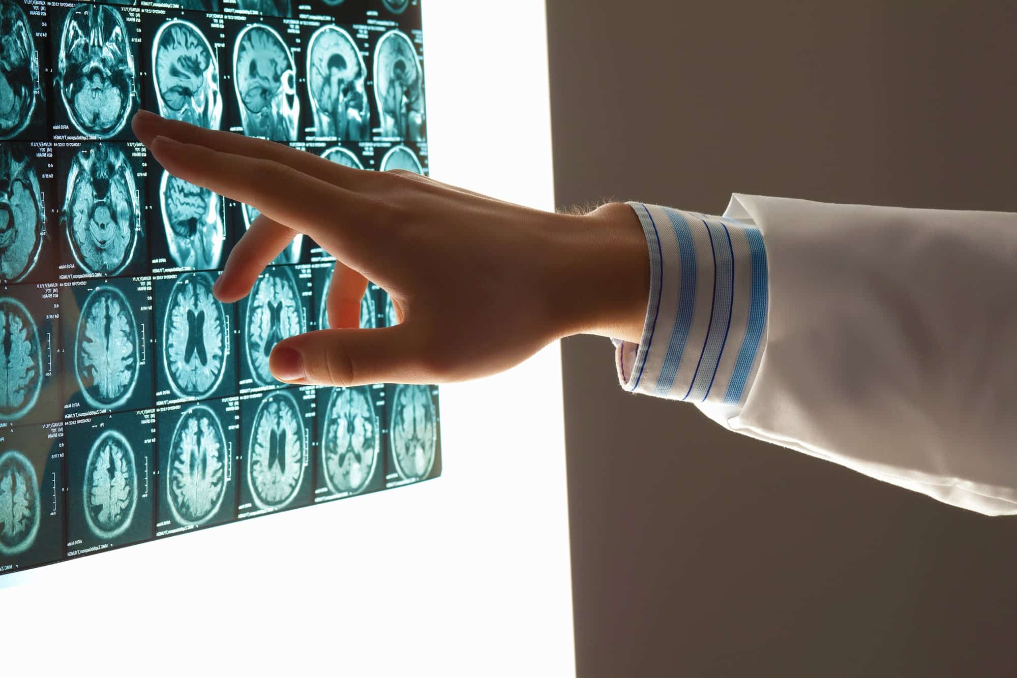 Evanston Brain Injury Lawyer 1 Brain Injury Lawyer Evanston, IL